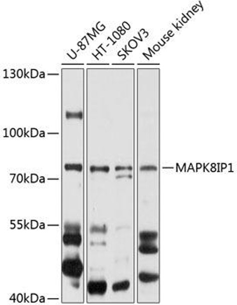 Cell Biology Antibodies 12 Anti-MAPK8IP1 Antibody CAB9011