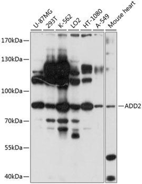 Cell Biology Antibodies 12 Anti-Beta-adducin Antibody CAB9025