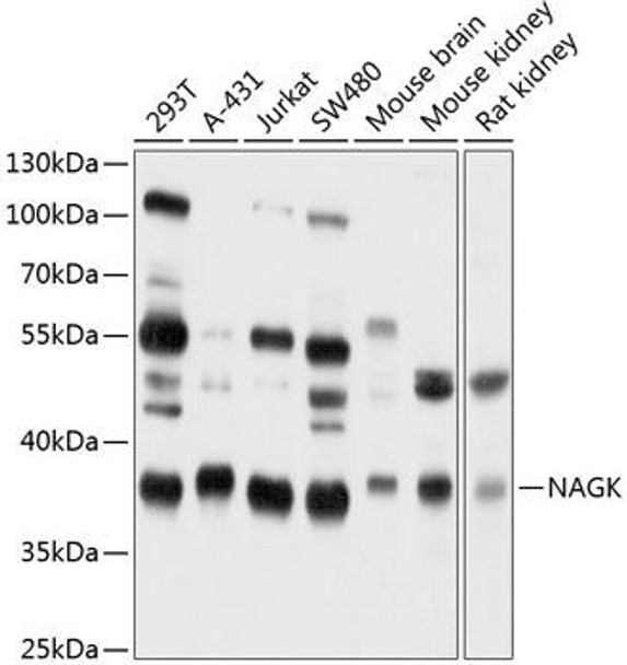Cell Biology Antibodies 12 Anti-NAGK Antibody CAB9070