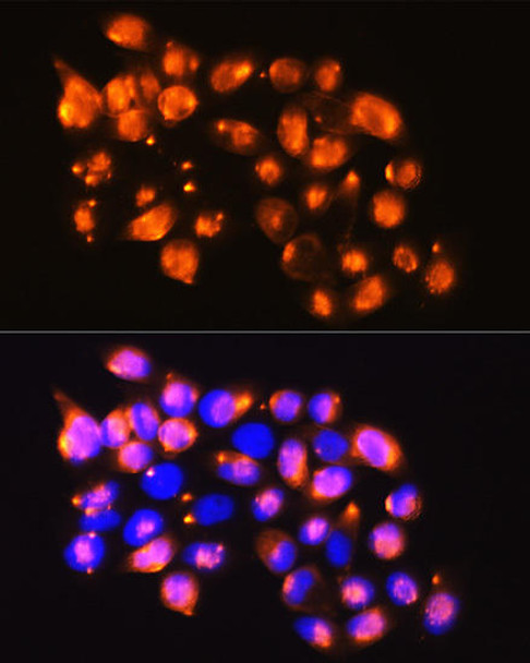 Cell Cycle Antibodies 2 Anti-EPB41L2 Antibody CAB9101