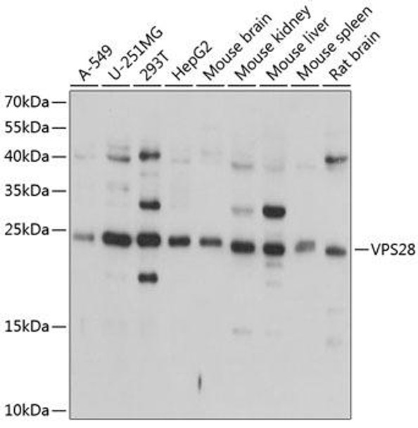Cell Biology Antibodies 12 Anti-VPS28 Antibody CAB9104