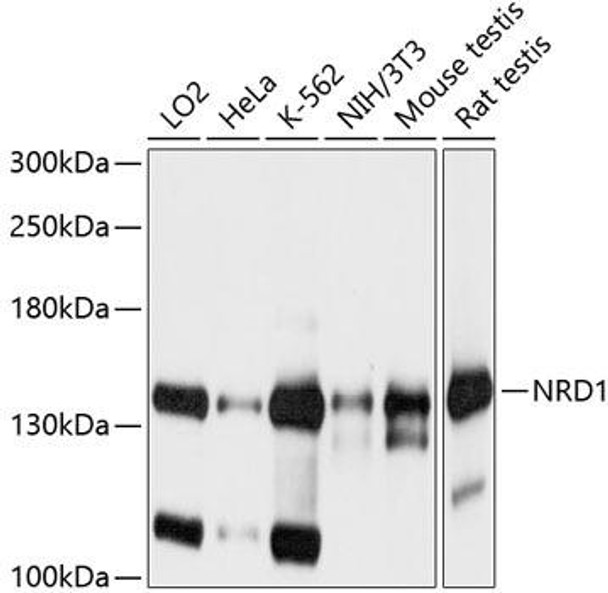 Cell Biology Antibodies 12 Anti-Nardilysin Antibody CAB9119