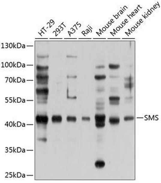 Metabolism Antibodies 3 Anti-Spermine synthase Antibody CAB9154