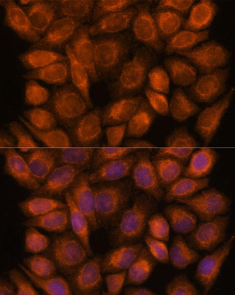 Cell Biology Antibodies 12 Anti-SNX15 Antibody CAB9158