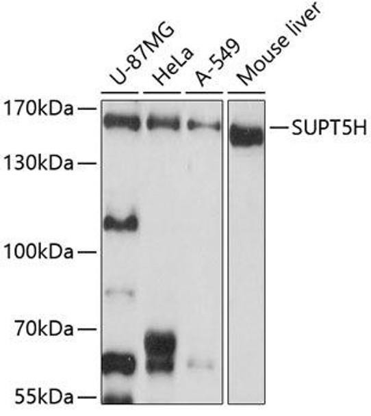 Epigenetics and Nuclear Signaling Antibodies 4 Anti-SUPT5H Antibody CAB9193