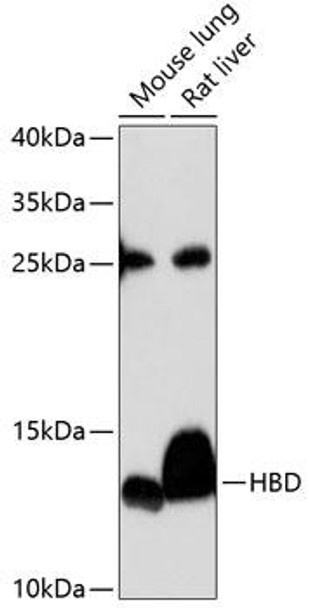 ChIP Antibodies Anti-HBD Antibody CAB9220