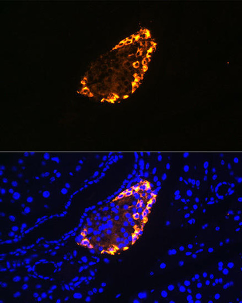 Cell Biology Antibodies 12 Anti-Somatostatin Antibody CAB9274