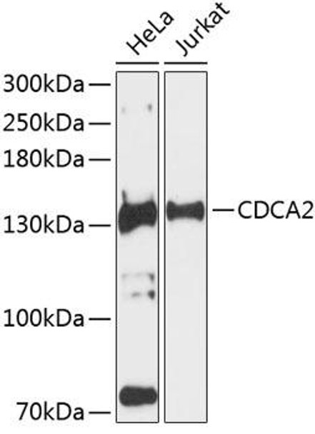 Cell Cycle Antibodies 2 Anti-CDCA2 Antibody CAB9291