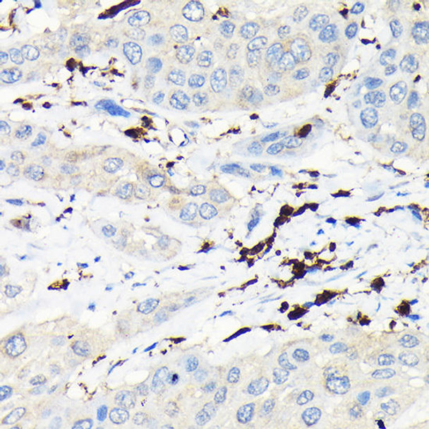 Cell Biology Antibodies 12 Anti-Coronin-1A Antibody CAB9300