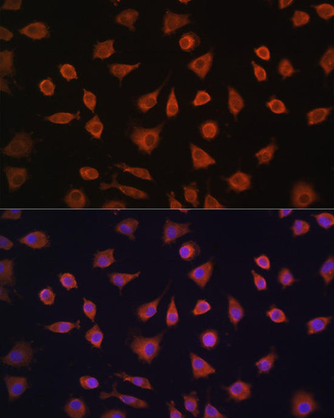 Cell Biology Antibodies 12 Anti-PFKFB2 Antibody CAB9311