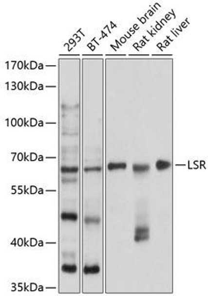 Cell Biology Antibodies 12 Anti-LSR Antibody CAB9340