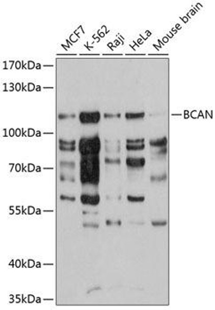 Cell Biology Antibodies 12 Anti-BCAN Antibody CAB9368