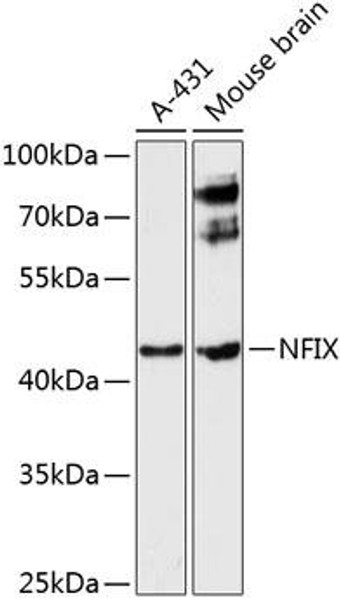 Epigenetics and Nuclear Signaling Antibodies 4 Anti-NFIX Antibody CAB9390