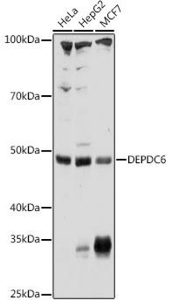 Cell Biology Antibodies 12 Anti-DEPDC6 Antibody CAB9447