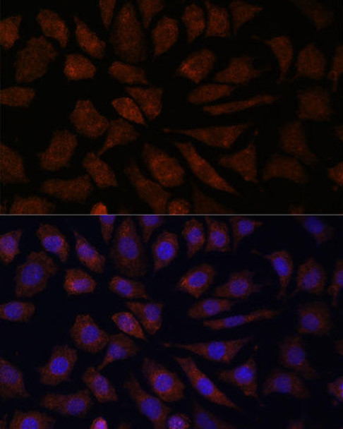 Immunology Antibodies 3 Anti-OAS3 Antibody CAB9481