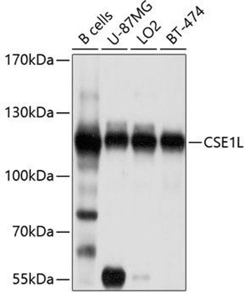 Cell Biology Antibodies 12 Anti-Exportin-2 Antibody CAB9510