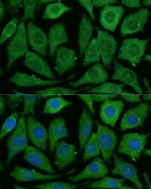 Cell Biology Antibodies 12 Anti-SARDH Antibody CAB9541