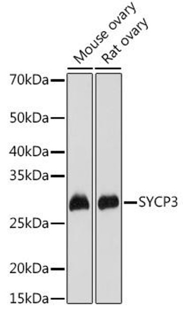 Cell Cycle Antibodies 2 Anti-SYCP3 Antibody CAB9548