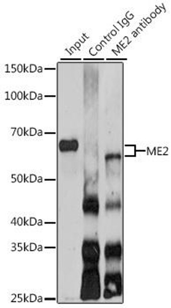 Cell Biology Antibodies 12 Anti-ME2 Antibody CAB9650