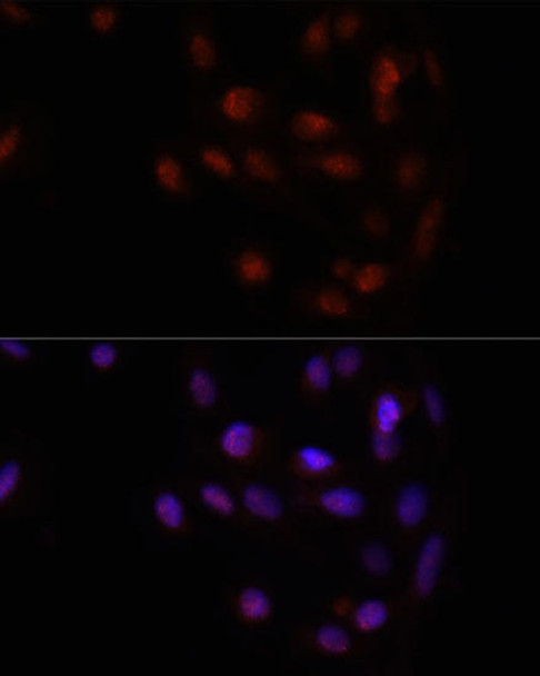 Epigenetics and Nuclear Signaling Antibodies 4 Anti-HOXA2 Antibody CAB9658