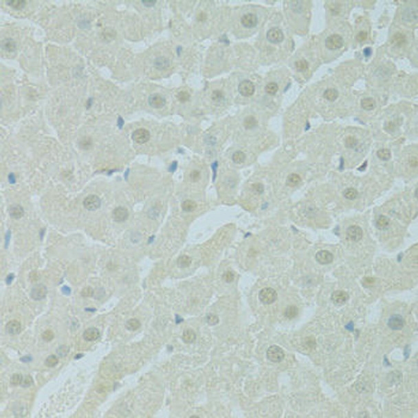 Epigenetics and Nuclear Signaling Antibodies 4 Anti-PHOX2B Antibody CAB9685