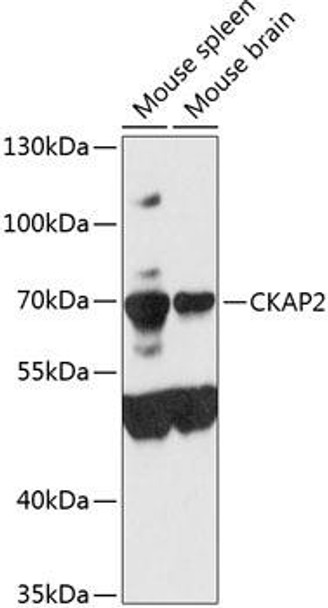 Cell Death Antibodies 2 Anti-CKAP2 Antibody CAB9706
