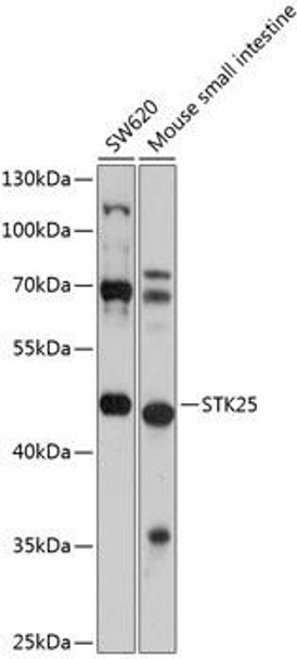 Cell Biology Antibodies 12 Anti-STK25 Antibody CAB9726