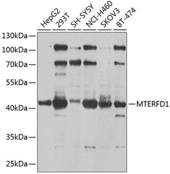 Cell Biology Antibodies 12 Anti-MTERFD1 Antibody CAB9804