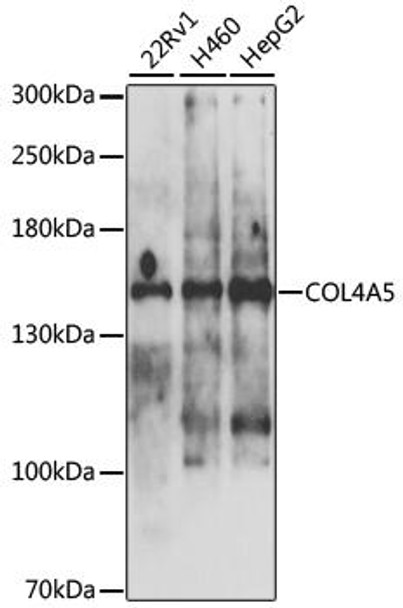 Cell Biology Antibodies 12 Anti-COL4A5 Antibody CAB9809
