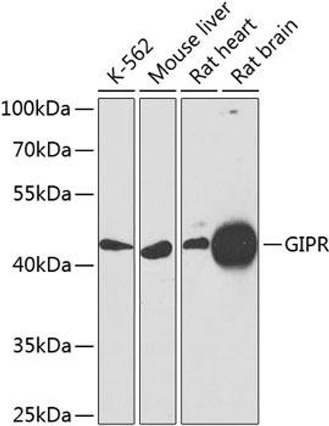 Cell Biology Antibodies 12 Anti-GIPR Antibody CAB9816