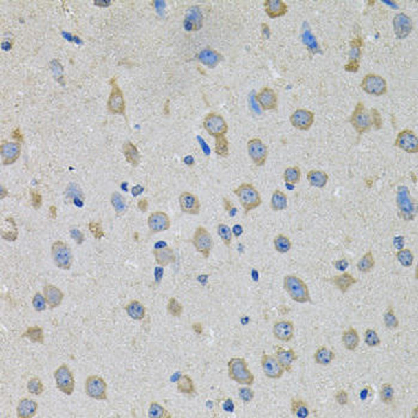 Cell Biology Antibodies 12 Anti-PTK7 Antibody CAB9839