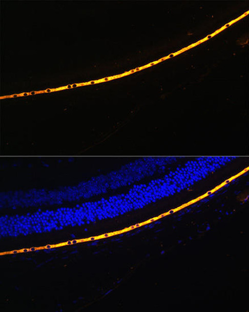 Signal Transduction Antibodies 3 Anti-RPE65 Antibody CAB9841