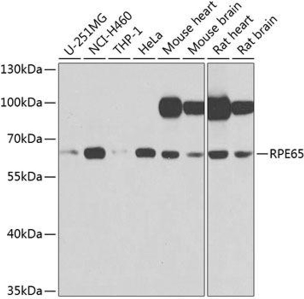 Signal Transduction Antibodies 3 Anti-RPE65 Antibody CAB9841