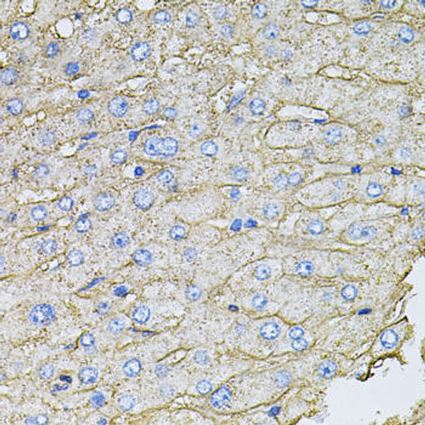 Signal Transduction Antibodies 3 Anti-SLC2A2 Antibody CAB9843