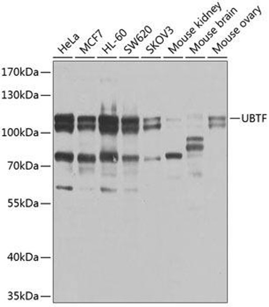 Epigenetics and Nuclear Signaling Antibodies 4 Anti-UBTF Antibody CAB9847