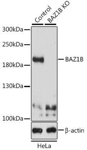 KO Validated Antibodies 1 Anti-BAZ1B Antibody CAB9851KO Validated