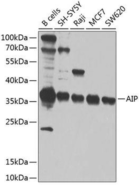 Cell Biology Antibodies 12 Anti-AIP Antibody CAB9852