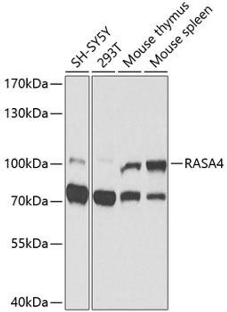 Cell Biology Antibodies 12 Anti-RASA4 Antibody CAB9860