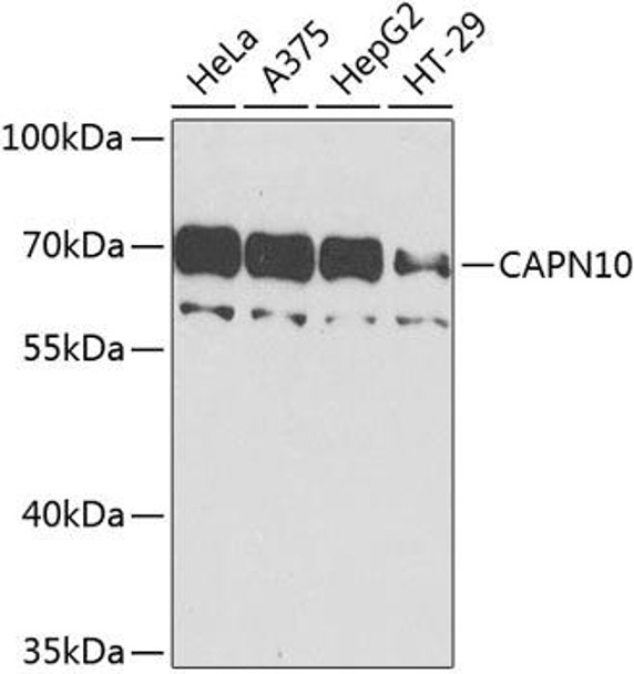Cell Biology Antibodies 12 Anti-Calpain-10 Antibody CAB9865