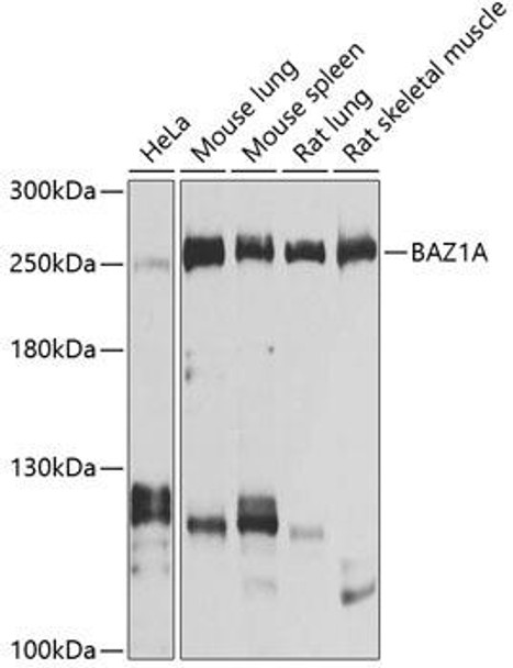 Epigenetics and Nuclear Signaling Antibodies 4 Anti-BAZ1A Antibody CAB9866