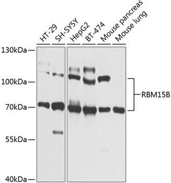 Immunology Antibodies 3 Anti-RBM15B Antibody CAB9873