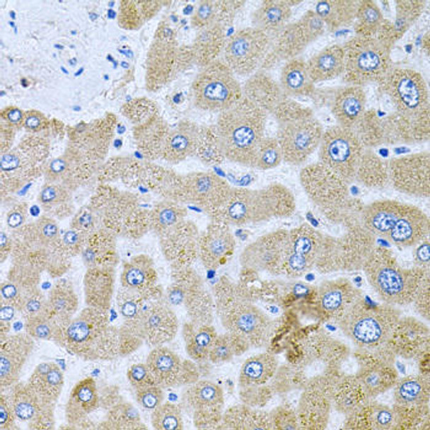 Cell Biology Antibodies 12 Anti-POMGNT1 Antibody CAB9879