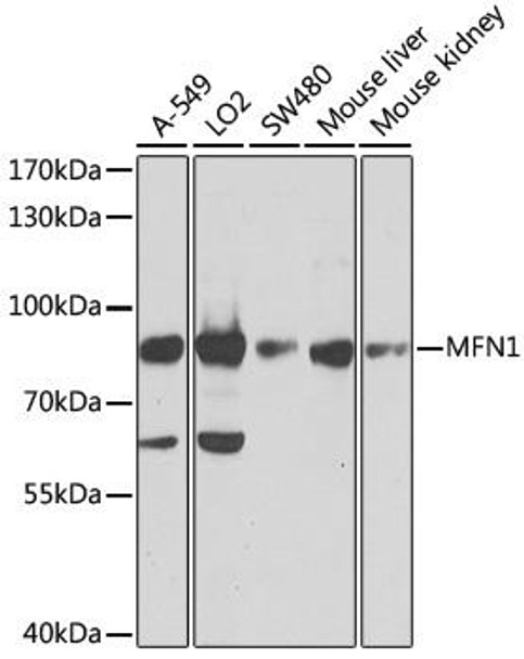 Cell Biology Antibodies 12 Anti-Mitofusin-1 Antibody CAB9880