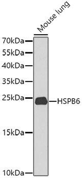 Metabolism Antibodies 3 Anti-HSPB6 Antibody CAB9887