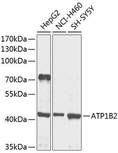 Cell Biology Antibodies 12 Anti-ATP1B2 Antibody CAB9928