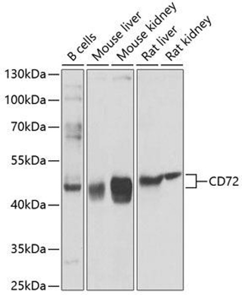 Cell Biology Antibodies 12 Anti-CD72 Antibody CAB9930