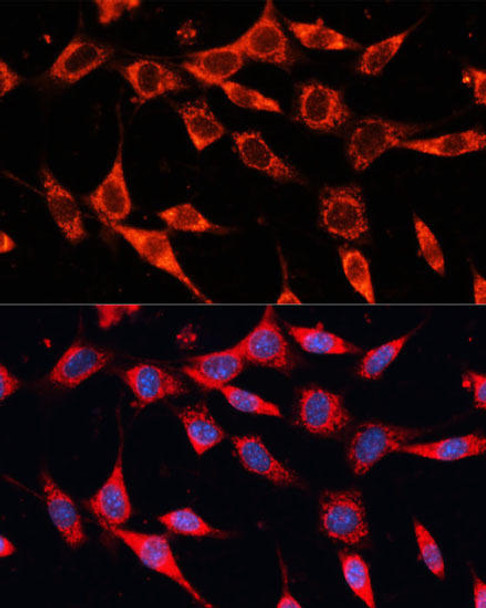 Metabolism Antibodies 3 Anti-PDHA2 Antibody CAB9943