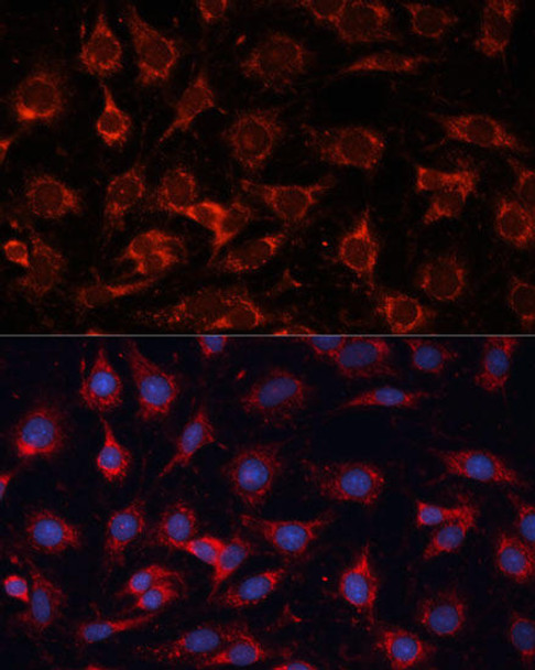 Metabolism Antibodies 3 Anti-PDHA2 Antibody CAB9943