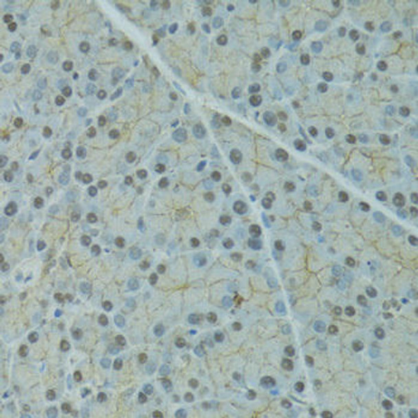 Immunology Antibodies 3 Anti-Alpha-2-antiplasmin Antibody CAB9945