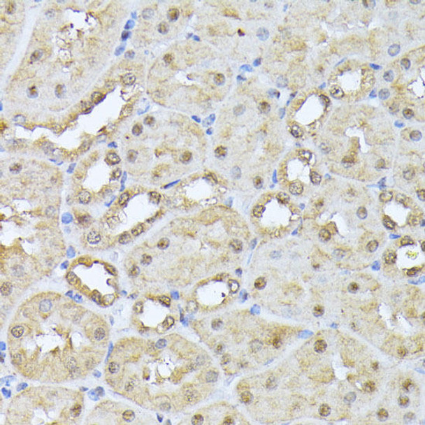 Immunology Antibodies 3 Anti-PSMB3 Antibody CAB9947